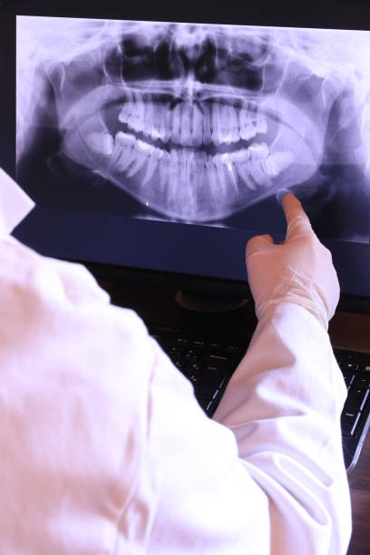 Best Cracked Tooth Emergency Dentist  in Haverford College, PA